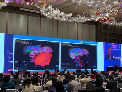 青大附院院長董蒨 海信CAS走向全球，展示中國根技術(shù)在國際前沿舞臺